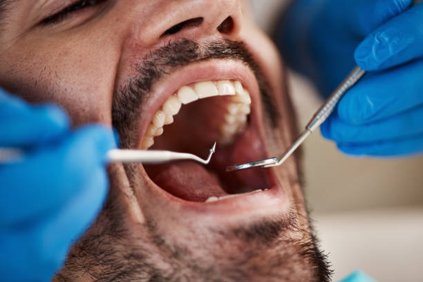 Best Affordable Emergency Dental Care  in Buhler, KS